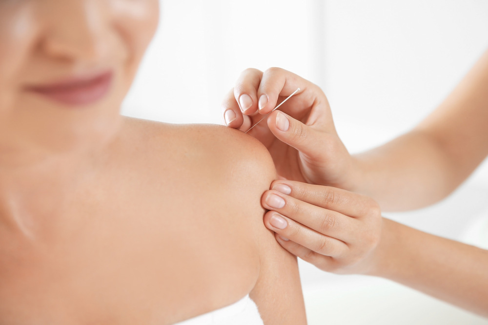 Acupuncture Vs. Chiropractic: Which Is Best For You