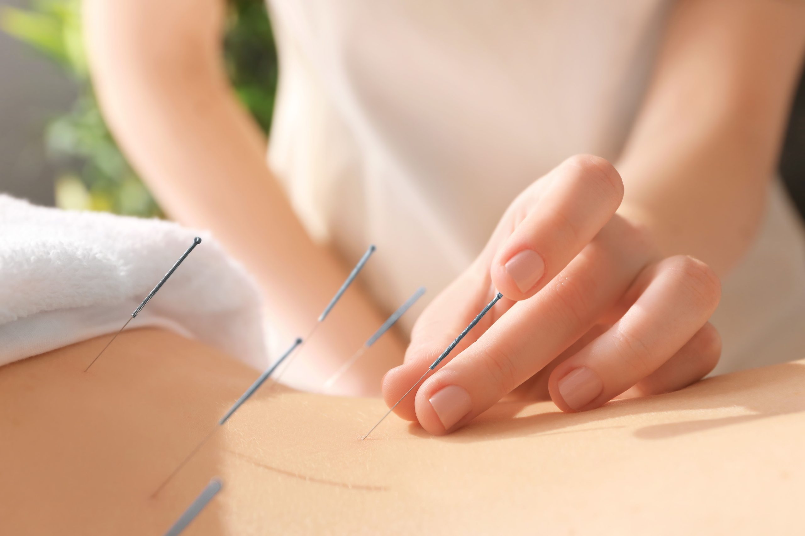 Acupuncture For Back Pain: Benefits, Possible Risks, And Techniques