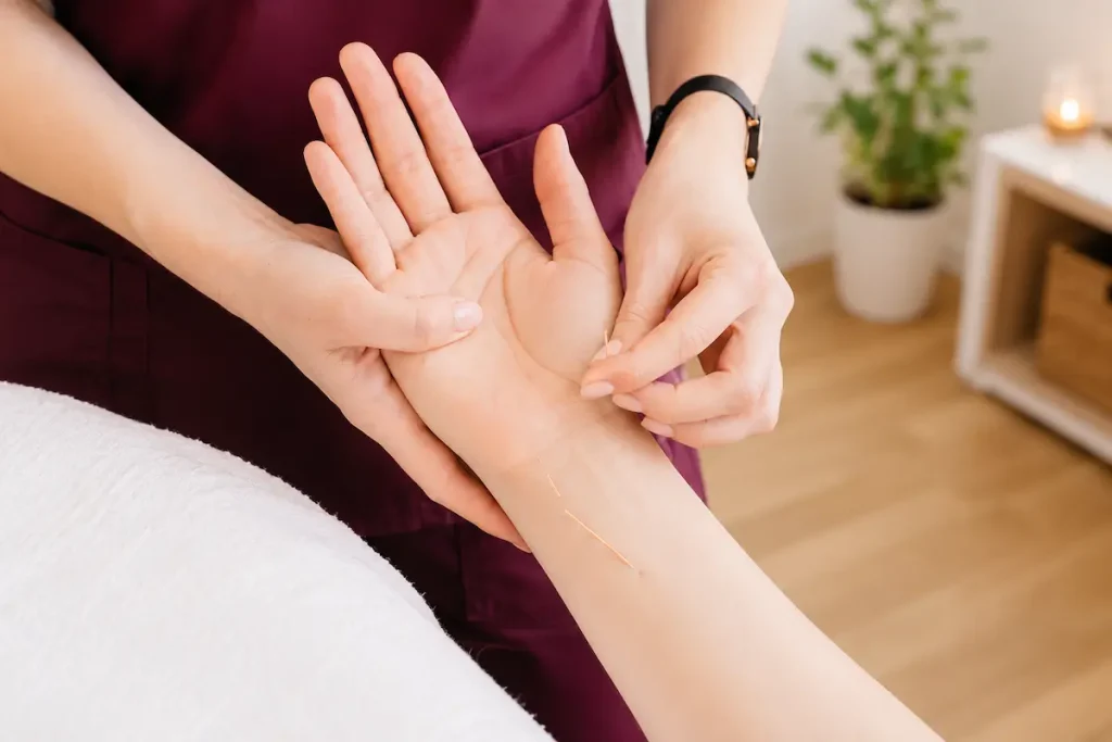 Acupuncture for Carpal Tunnel Syndrome: A Setauket Guide 1 Acupuncture for carpal tunnel syndrome in the wrist and hand