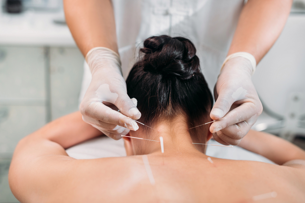 Acupuncture As A Treatment For Insomnia