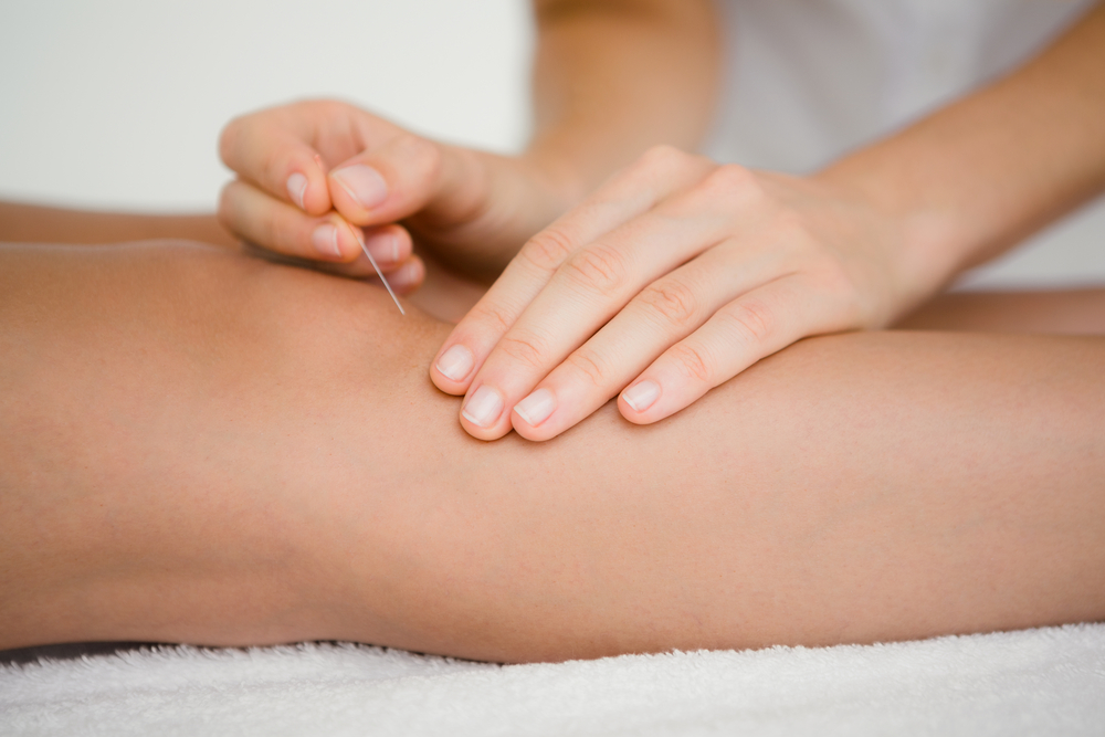 Acupuncture For Knee Pain: How It Works, Cost Breakdown, And What To Expect