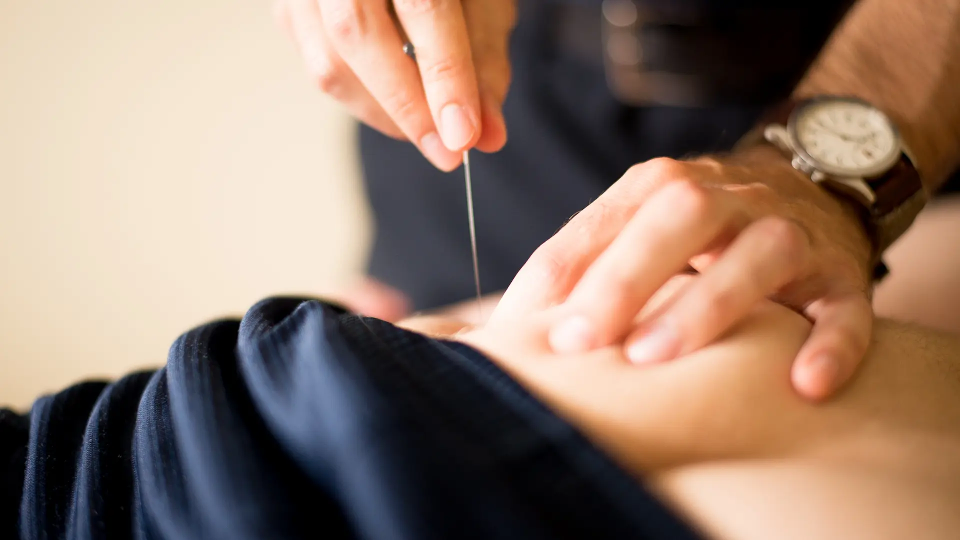 Acupuncturist inserting a thin needle into the lower back area