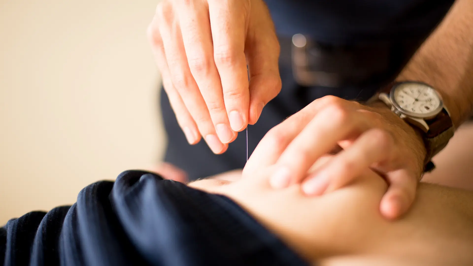 Acupuncturist inserting a needle into the lower back during therapy