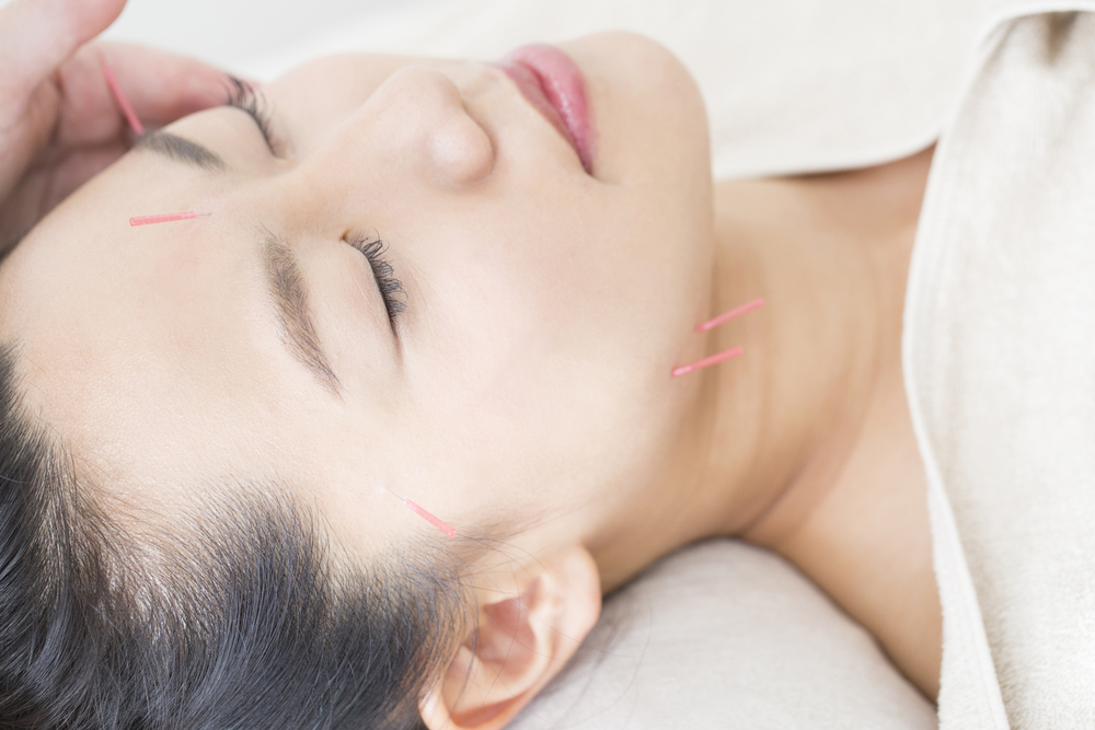Acupuncture's Role In Alleviating TMJ Pain: Does It Deliver Results?