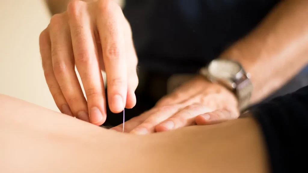 What Not to Do Before Acupuncture: 8 Practical Tips for Your Appointment 1 Acupuncturist inserting a thin needle into a patient’s back during treatment
