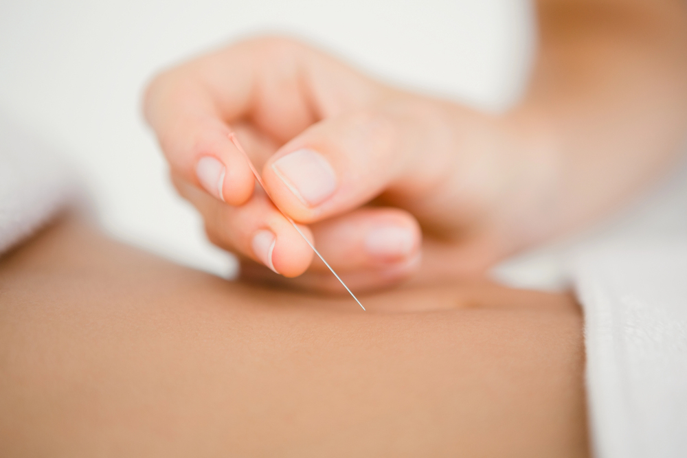 Does Acupuncture Work For Fibroids?