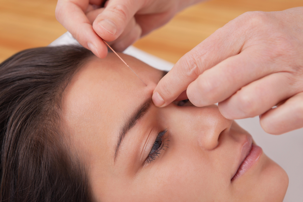 Dry Needling Expenses: How Much Does The Treatment Cost?