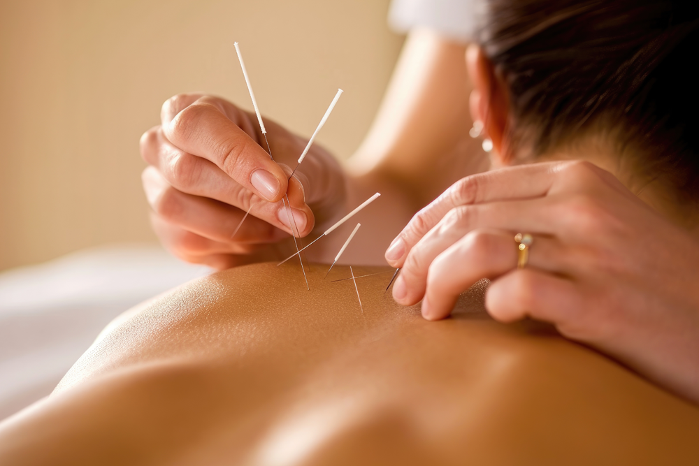 Dry Needling Vs. Wet Needling: Learn The Difference