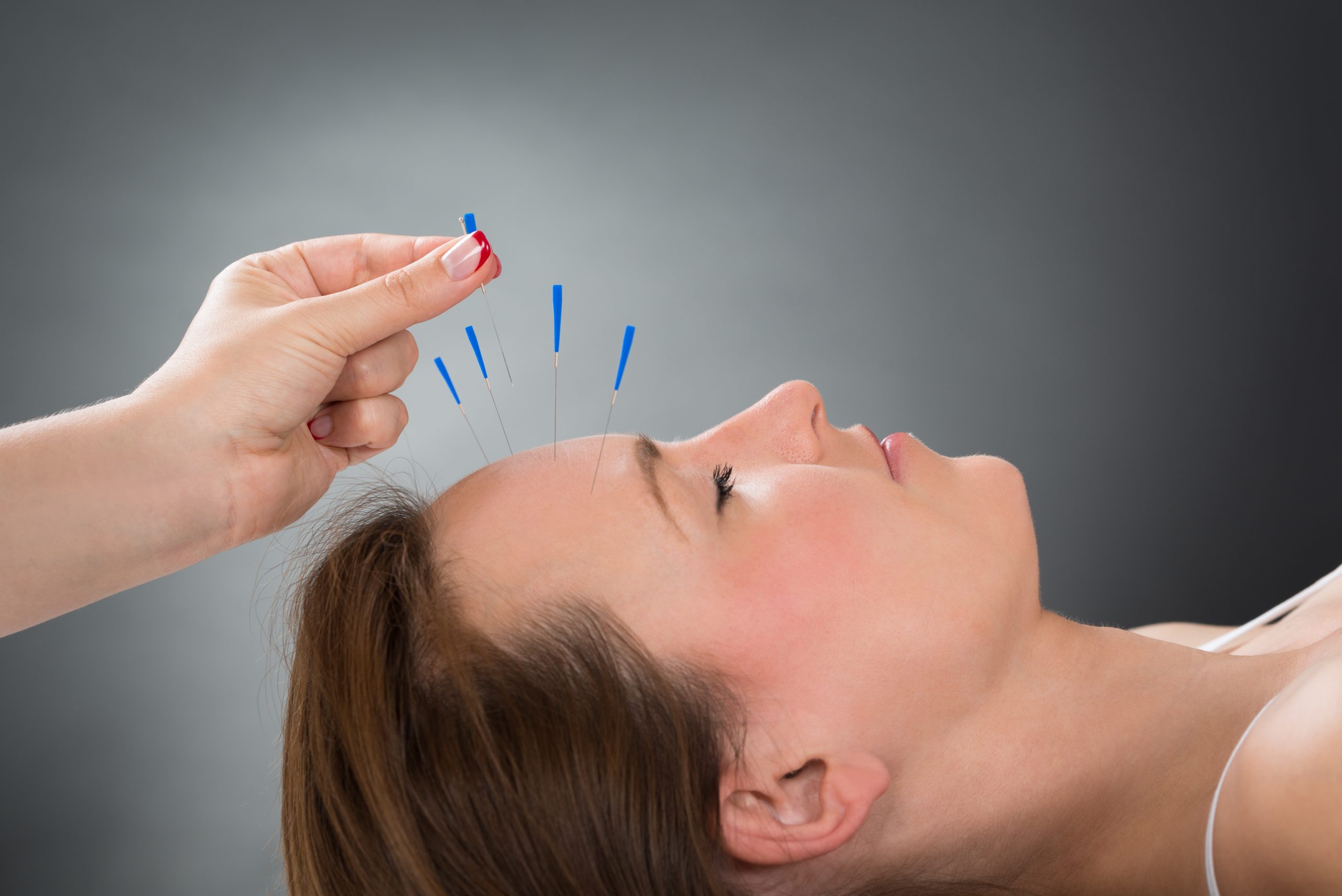 Person Putting Acupuncture Needle On Face Of Woman