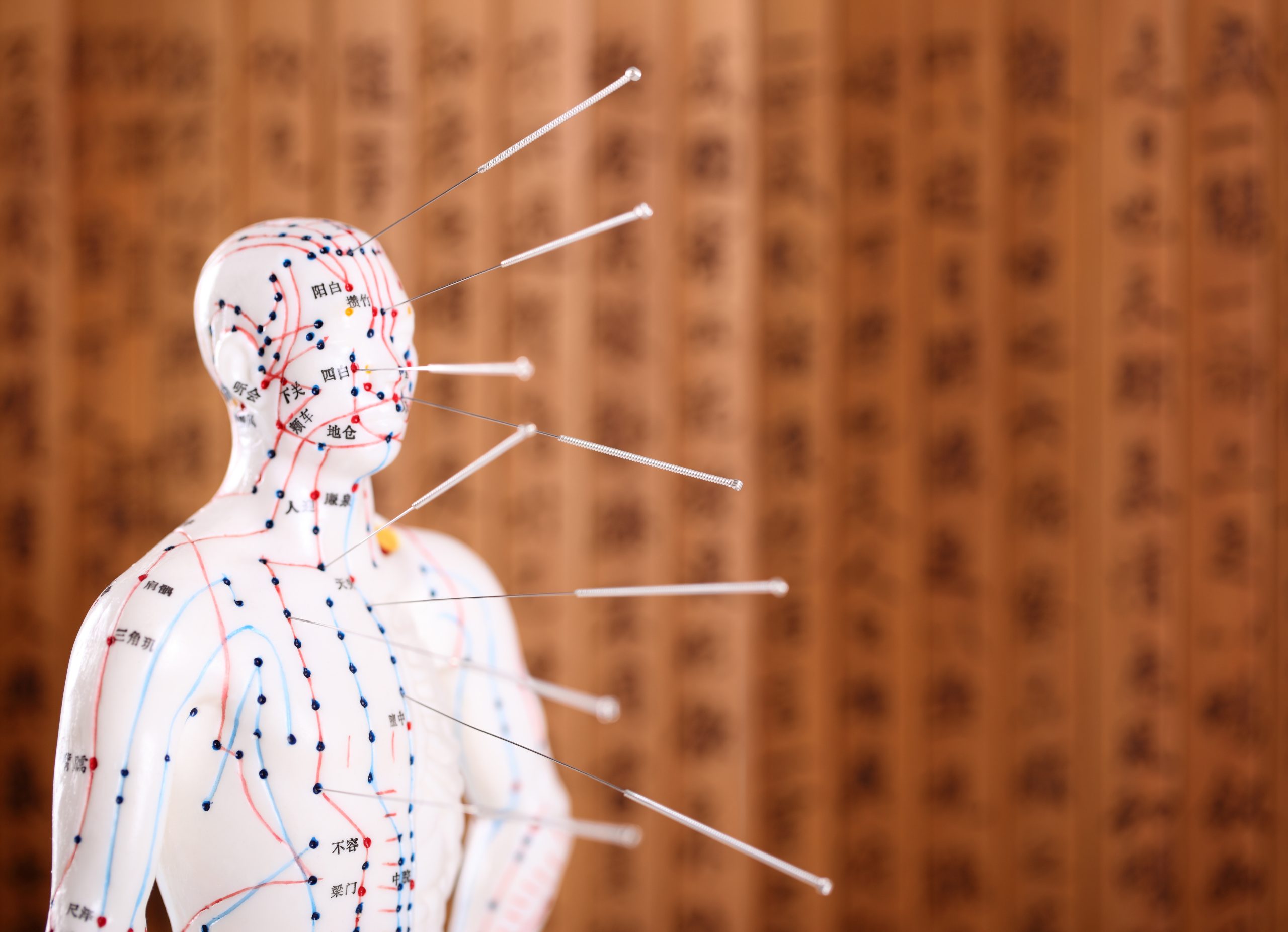 Eastern or Asian acupuncture Medical Treatment.