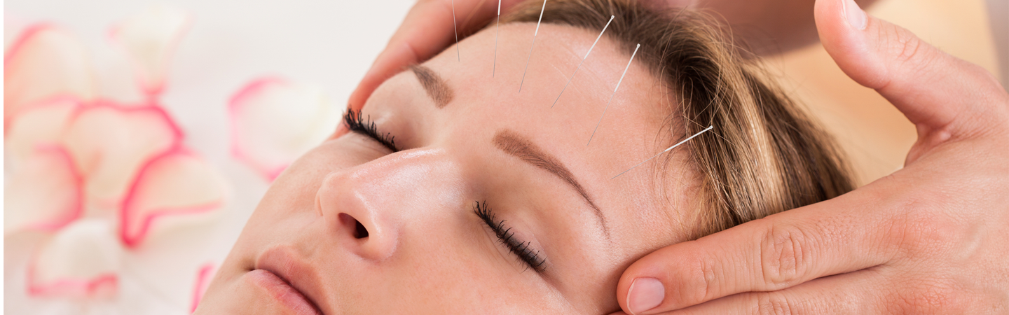 A Holistic Approach To Health: Your Guide To Acupuncture