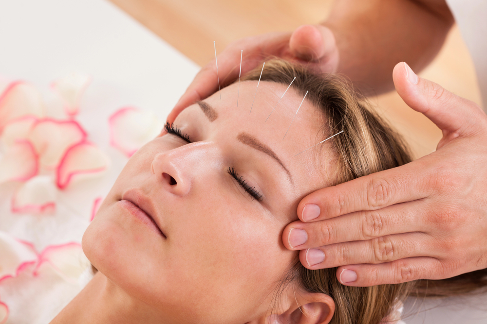 How Acupuncture Can Help Relieve Stress