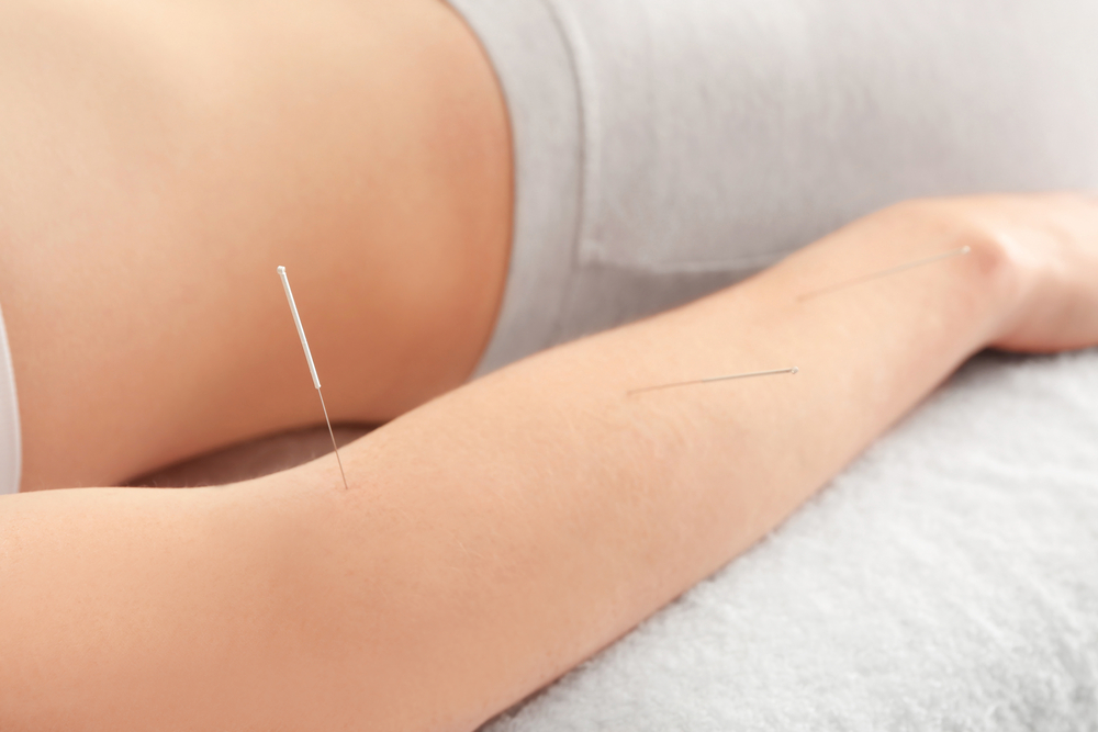 Is Acupuncture An Effective Remedy For Arthritis Pain?