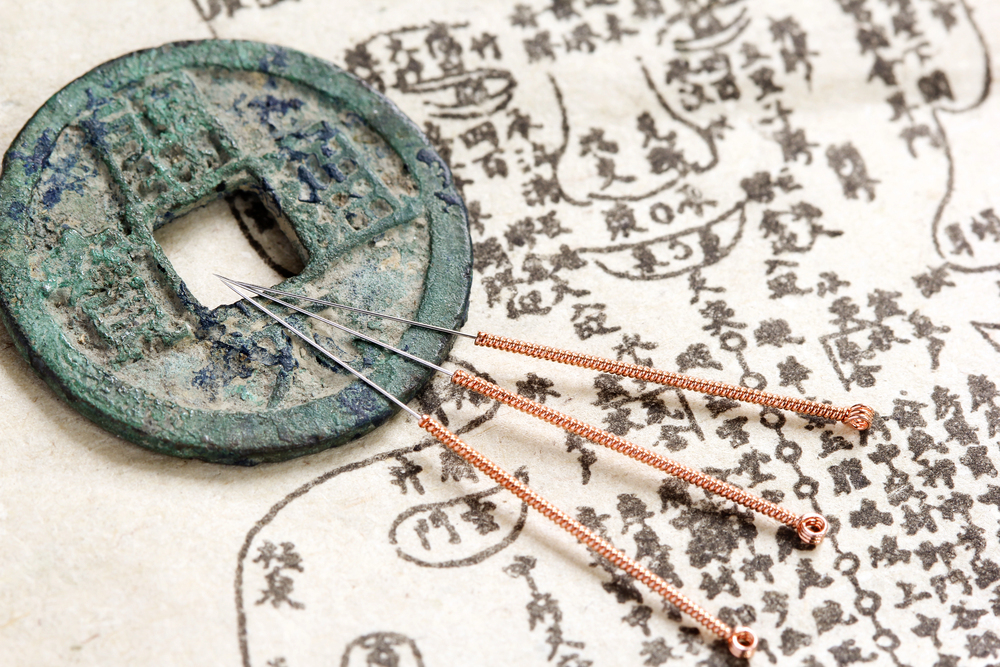 The History Of Acupuncture: From Ancient Practices To Modern Medicine