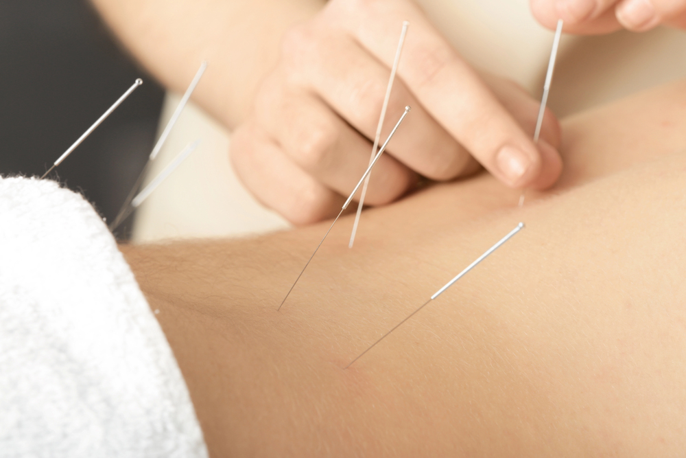 Trigger Point Injections Vs. Dry Needling: Selecting The Right Treatment