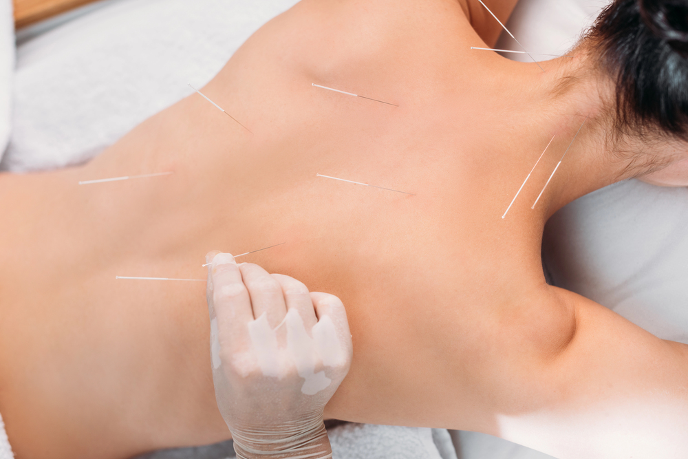9 Common Detox Symptoms After Acupuncture